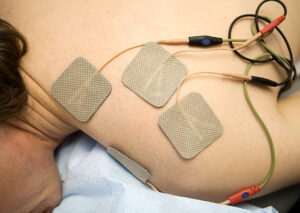 Electrical stimulation of a patient's shoulder.
